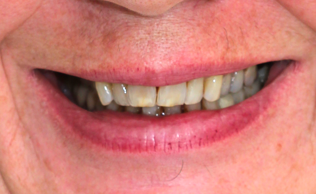 Odontologia Estética
